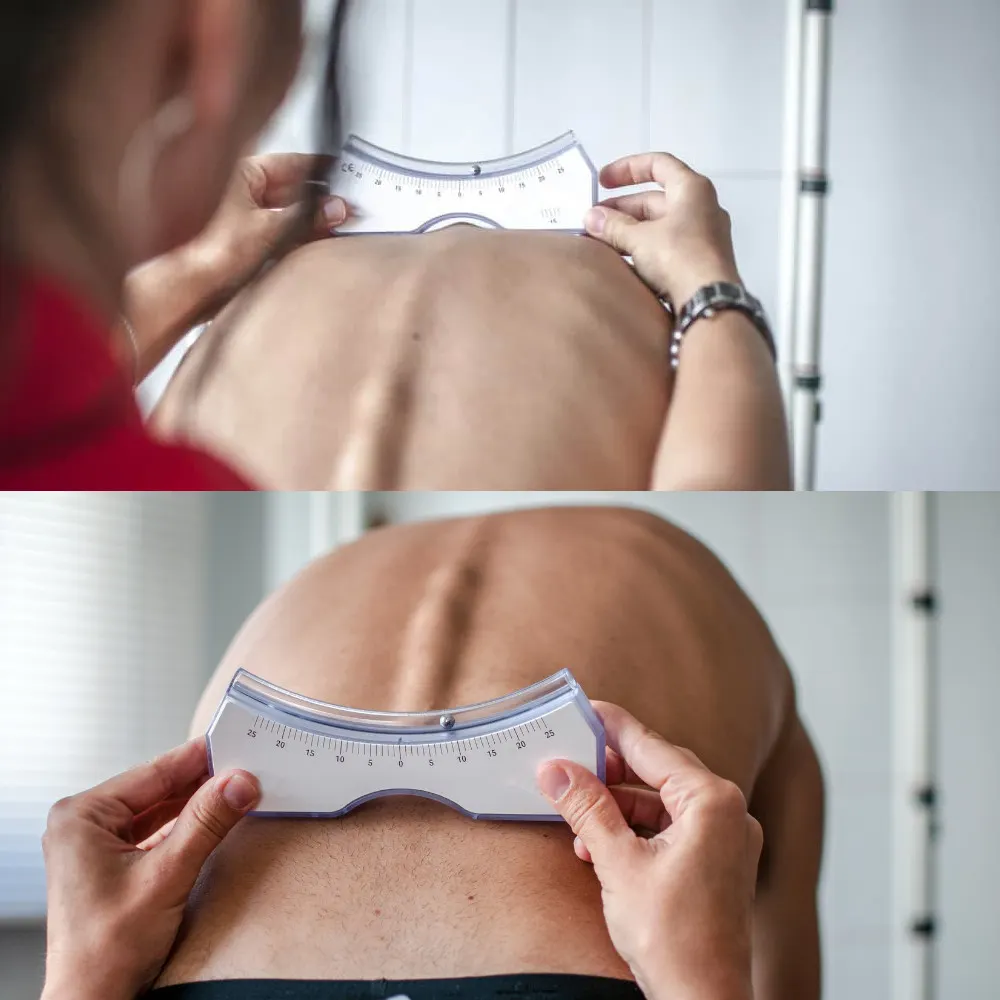Scoliosis and Posture: Tips for Maintaining a Healthy Spine