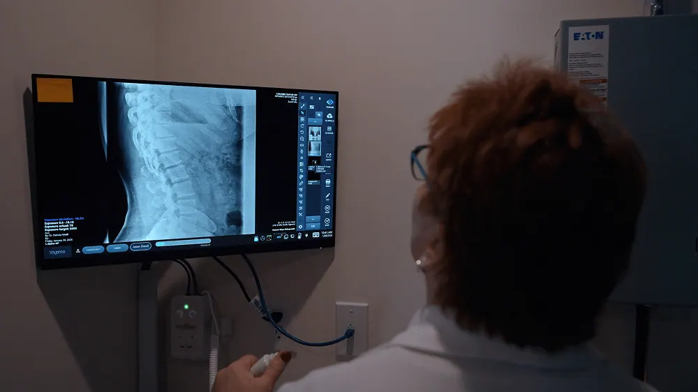 Digital X-ray of the lower spine displayed on a monitor